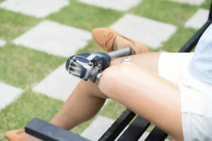 Amputation Injury